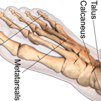 Image of what is a metatarsal guard