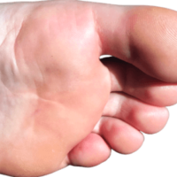 Image of best insoles for ball of foot pain